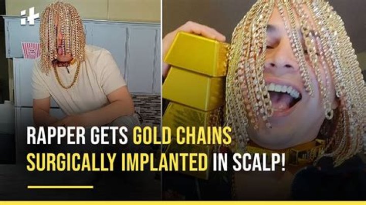 Dan Sur Says He's The First Rapper To Get Gold Chains Implanted Into Their Scalp