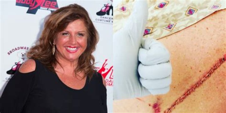Former ‘Dance Moms’ Star Abby Lee Miller Shares an Update After Undergoing Back Surgery