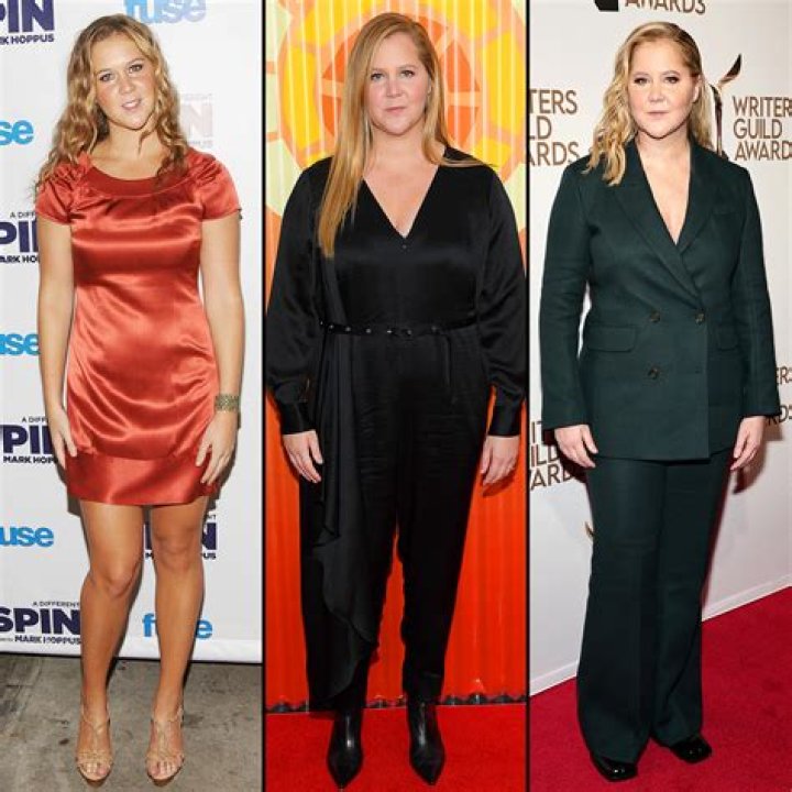 Amy Schumer Admits She Was Told to Lose Weight: “I’m What Hollywood Calls, Very Fat”