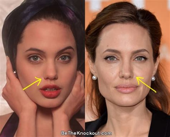 REPORTAngelina Jolie Underwent “Subtle Nose Job” – Plus More Stars Who Did the Same