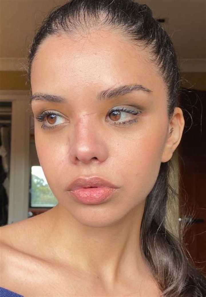 Are scars attractive on a woman? – Celebrity.fm – #1 Official Stars, Business & People Network, Wiki, Success story, Biography & Quotes