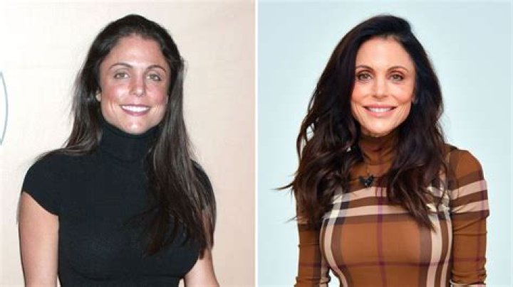 Has Bethenny Frankel Had Plastic Surgery? The Former ‘RHONY’ Star Details Past Procedures