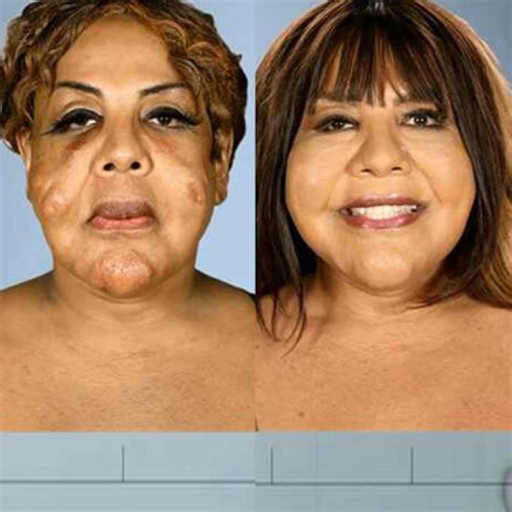 See the Most Extreme Plastic Surgery Transformations From ‘Botched’!