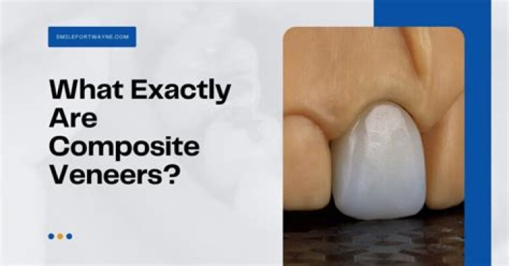 ¿Se pueden blanquear las carillas de composite? – Celebrity.fm