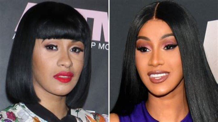 Cardi B Is Honest About Her Plastic Surgery Journey: See the Rapper’s Before and After Photos