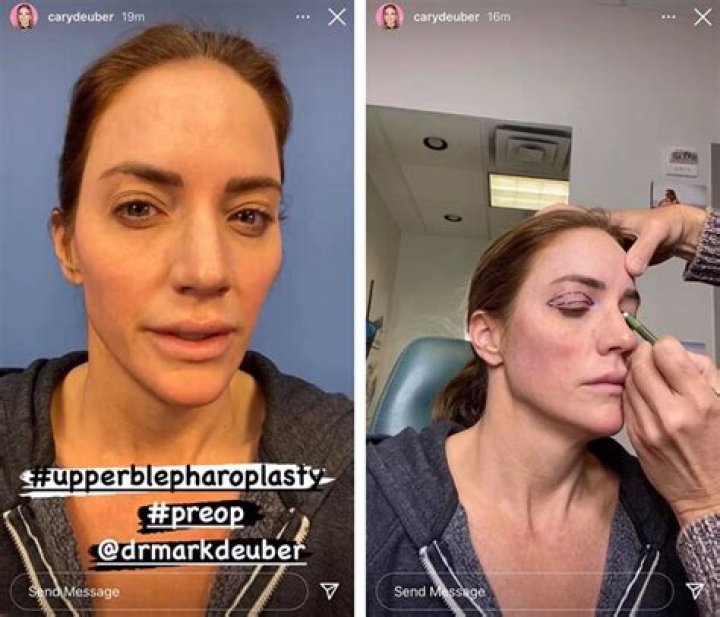 ‘RHOD’ Star Cary Deuber Shares Her Plastic Surgery Secrets: ‘I Do My Own Botox!’ (EXCLUSIVE)