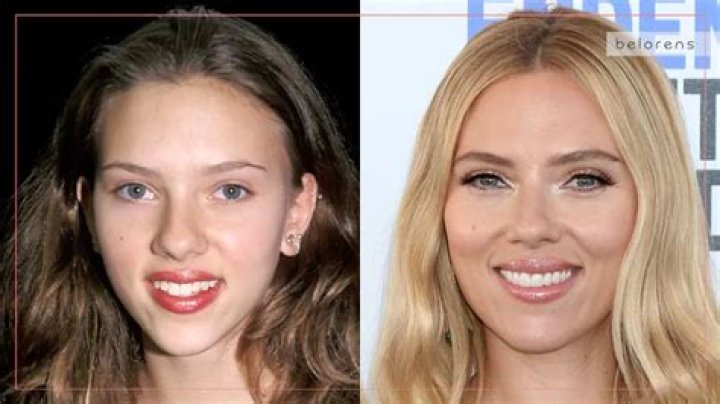 Jennifer Lopez, Kim Kardashian, and More Stars Who Are Rumored to Have Had Nose Jobs