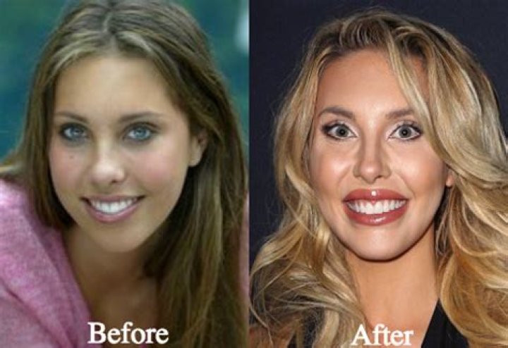 Chloe Lattanzi’s Prom Photo Shows Just How Much Surgery She’s Gotten Done Over the Years