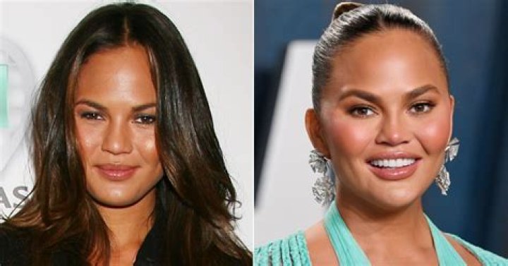 Did Chrissy Teigen Get Plastic Surgery? See Photos of Her Transformation Over the Years