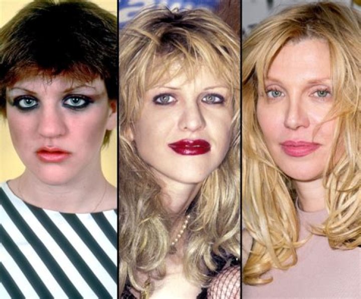 Plastic Surgery?See Courtney Love’s Shocking Transformation Right Before Your Eyes