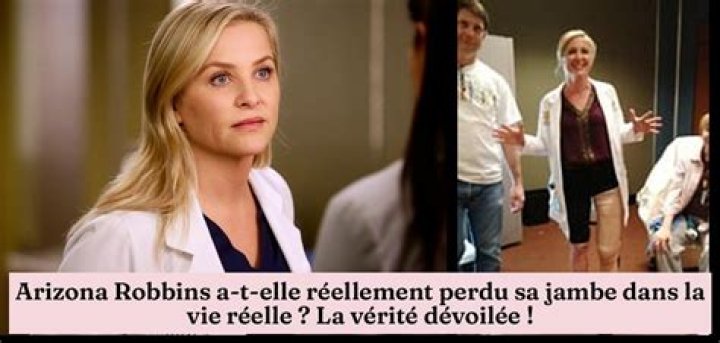 Did Arizona Robbins lose her leg in real life?