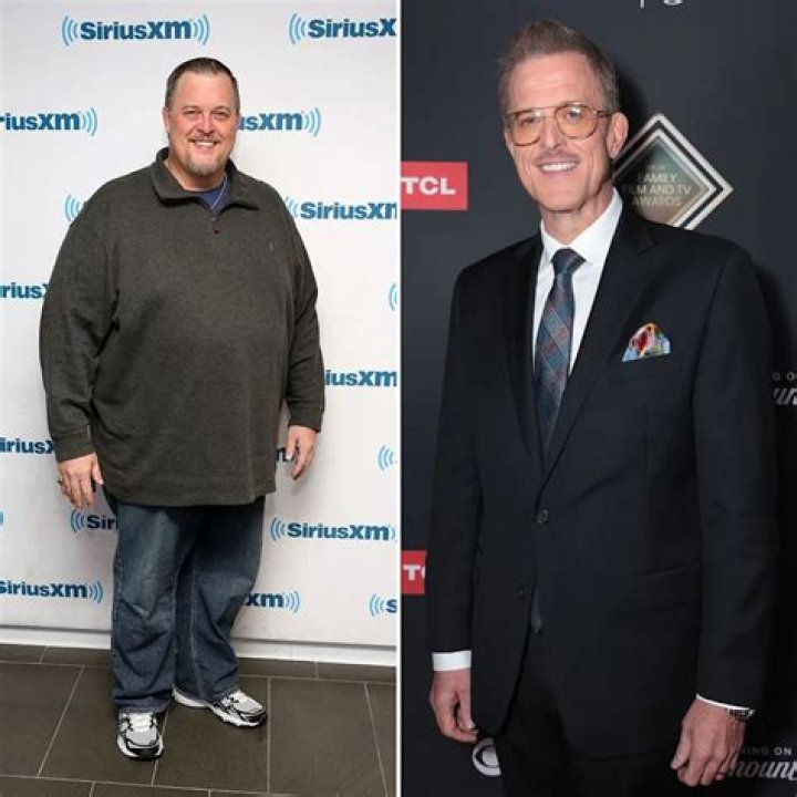 
Did Billy Gardell Have A Gastric Bypass Surgery, How Did He Lose All His Weight? 