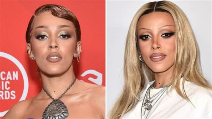 Did Doja Cat Ever Get Plastic Surgery? See Her Response, Photos of Her Transformation