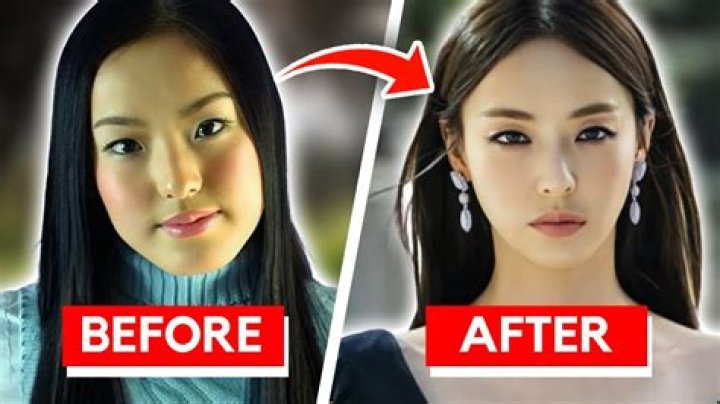 Did Kim Seon Ho Get His Nose Done? Before And After Plastic Surgery