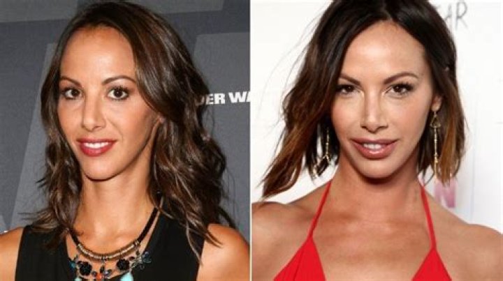 Did Kristen Doute Get Plastic Surgery? ‘Vanderpump Rules’ Star’s Quotes About Going Under the Knife