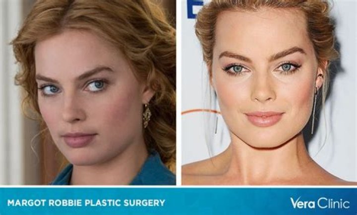 Life in Plastic … Surgery? See ‘Barbie’ Star Margot Robbie’s Total Transformation Over the Years