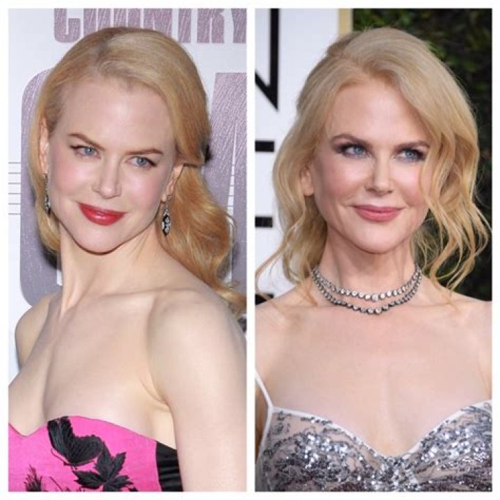 Gorgeous Then and Now! See Nicole Kidman’s Transformation Through the Years