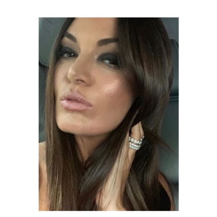 Did ‘RHOSLC’ Star Lisa Barlow Get Plastic Surgery? See Her Transformation Photos