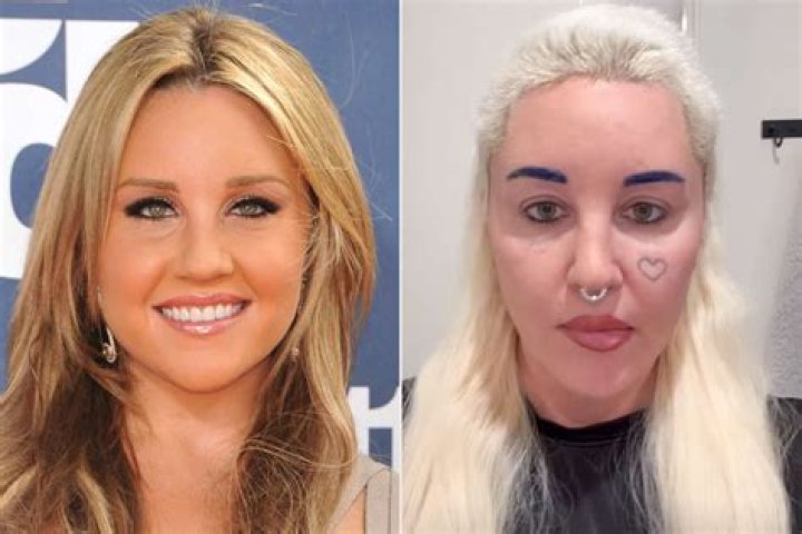 
Did Ulrika Jonsson Get Her Nose Done? Surgery Before And After 
