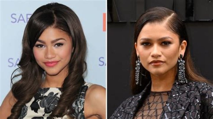 Did Zendaya Get Plastic Surgery? What She’s Said About Nose Job Speculation and Past Edited Photos