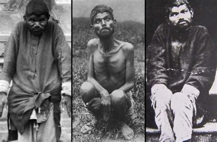 Dina Sanichar, The Real-Life 'Mowgli' Who Was Raised By Wolves