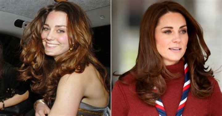 Plastic Surgery Expert Thinks It’s ‘Impossible’ for Kate Middleton to Not Have Used Botox, Despite Palace Claims