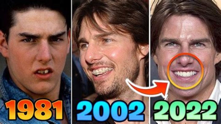 Does Tom Cruise wear dentures? – Celebrity.fm – #1 Official Stars, Business & People Network, Wiki, Success story, Biography & Quotes