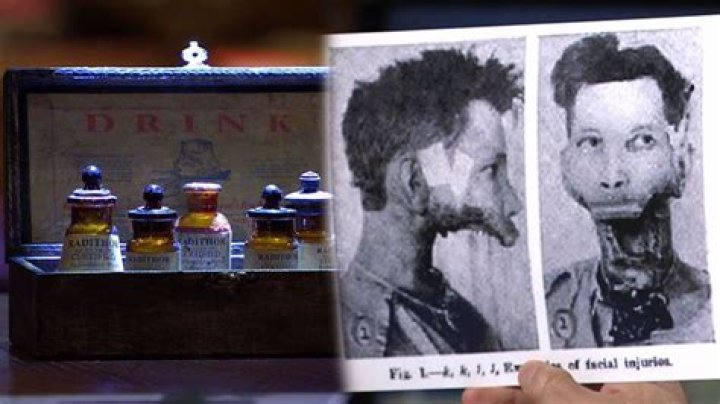 Eben Byers, The Man Who Drank Radium Until His Jaw Fell Off