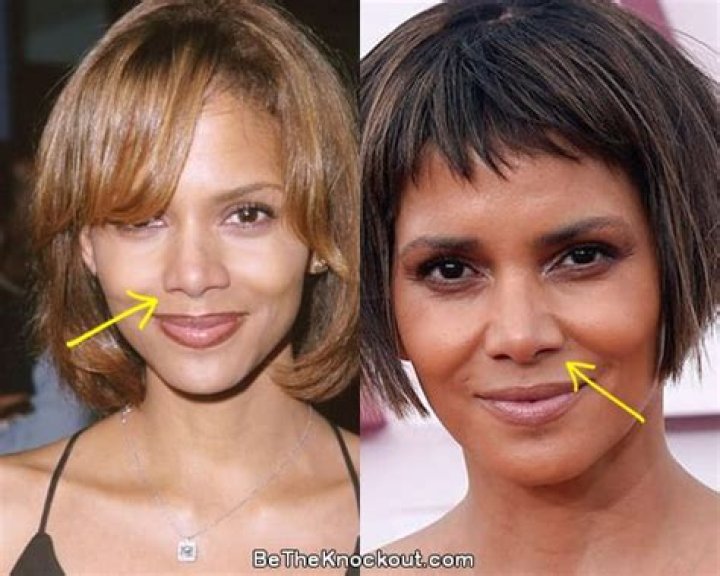 Has Halle Berry Had Plastic Surgery? Transformation Photos and What She’s Said About Cosmetic Work