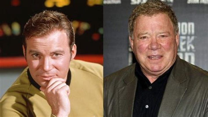 Has William Shatner Had Botox? Fans Curious About Jaw Lift And Hair Transplant