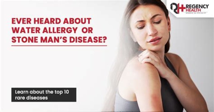 The Most Interesting Diseases To Have Ravaged Humanity