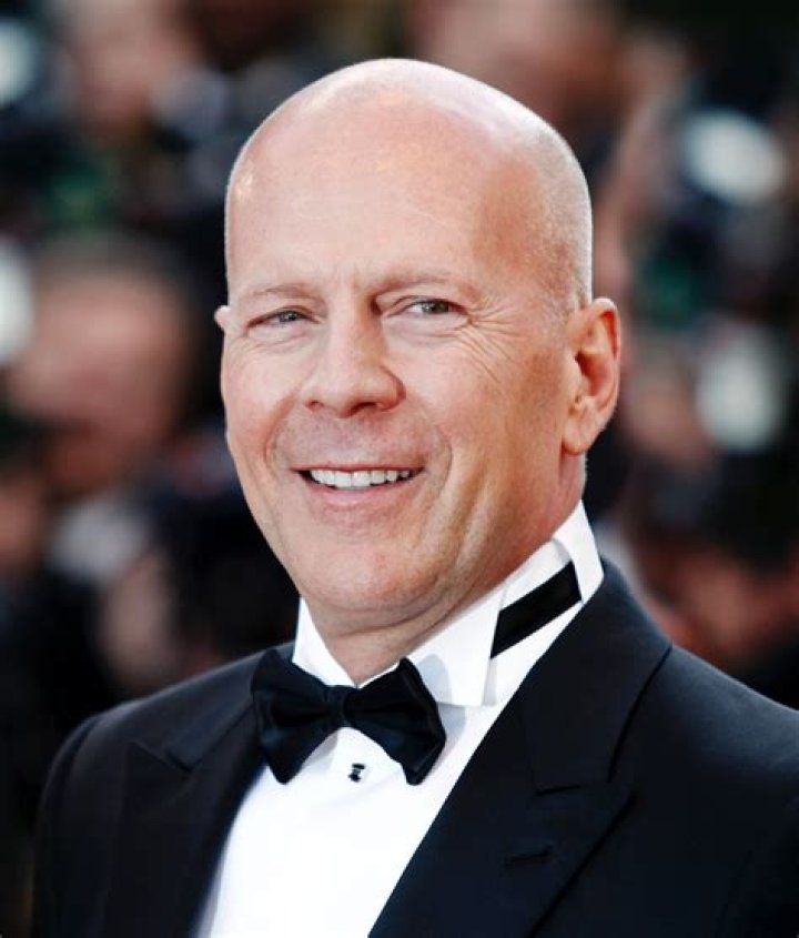 
Is John Rich Bald? What Happened To The American Country Music Singer Hair? 