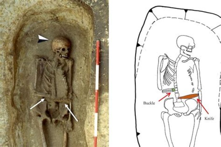 Medieval Italian Warrior Used A Bladed Weapon To Replace His Amputated Hand