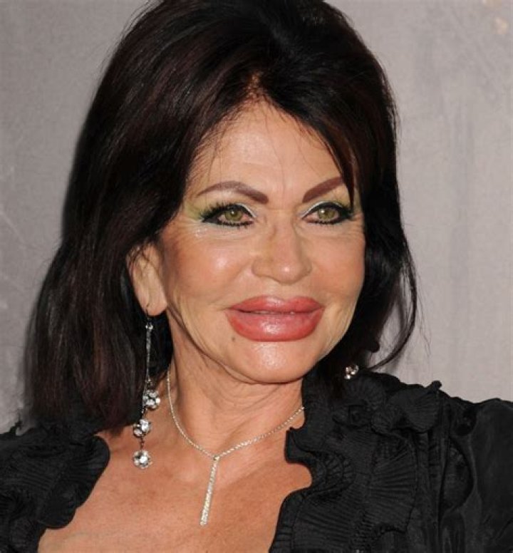 Plastic Surgery?See Jackie Stallone’s Shocking Transformation Right Before Your Eyes