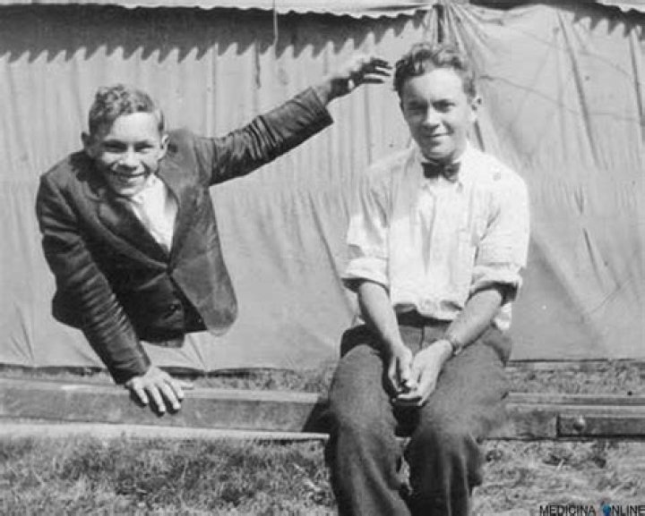 Johnny Eck Biography, Age, Height, Wife, Net Worth, Family