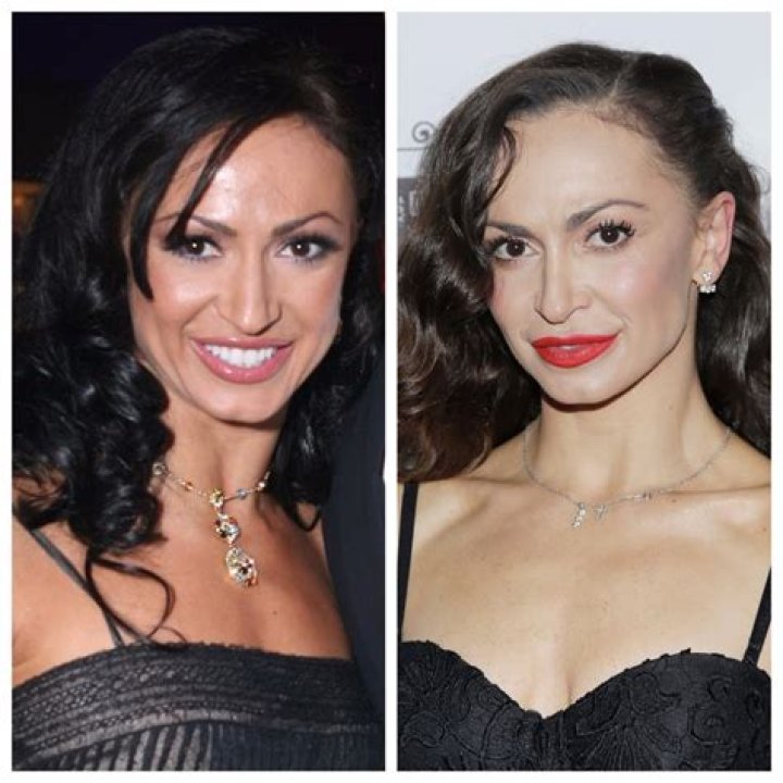 ‘DWTS’ Pro Karina Smirnoff Sparks New Plastic Surgery Rumors — and Experts Sound Off (EXCLUSIVE)