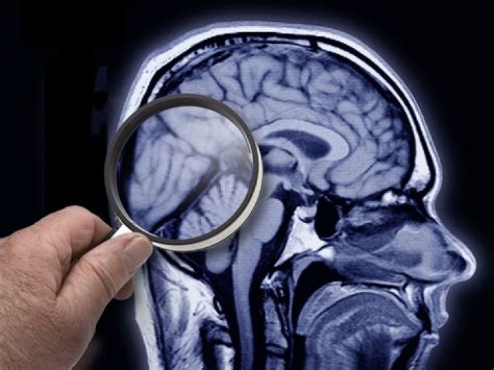 What Is Kuru, The Brain Disease Caused By Cannibalism?