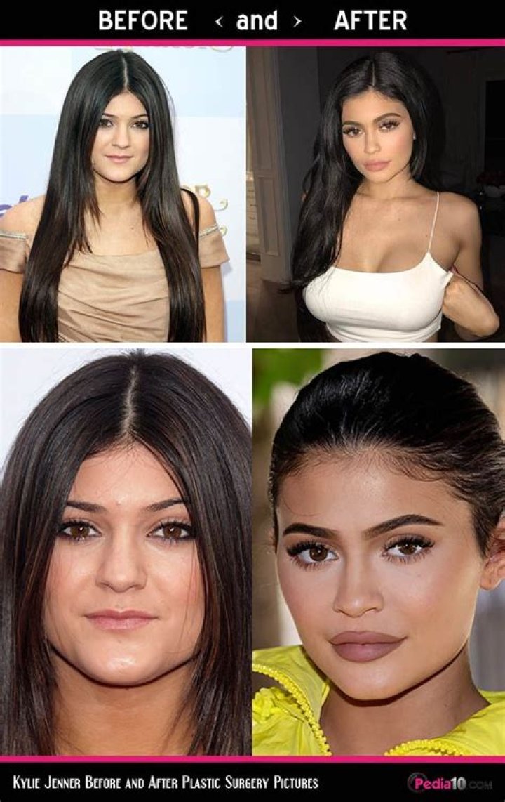 Hilarious Instagram Account Photoshops Kylie Jenner’s Old Face Onto New Photos!