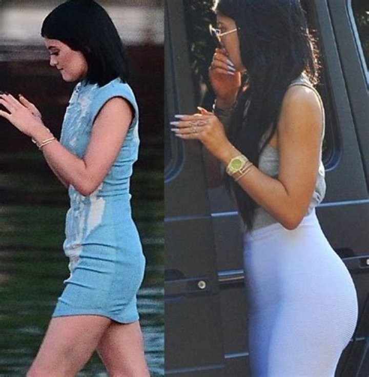 Plastic Surgery or Photoshop? Kylie Jenner Accused of Altering Her Butt in New Instagram Pic