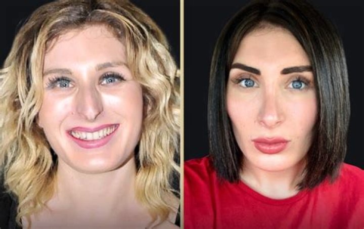 Laura Prepon Teeth Before And After Along With Plastic Surgery Details