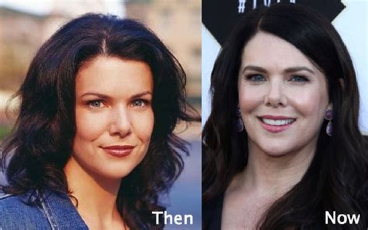 Did ‘Gilmore Girls’ Star Lauren Graham Ever Get Plastic Surgery? See Her Transformation!