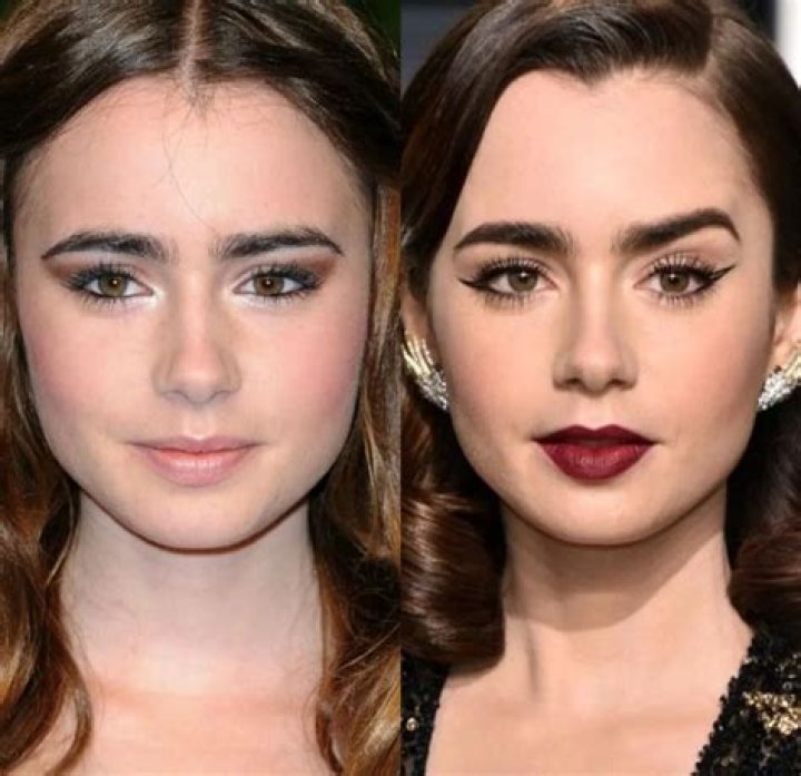 Lily Collins Plastic Surgery -Before And After Photos, Beauty Secret Explored!
