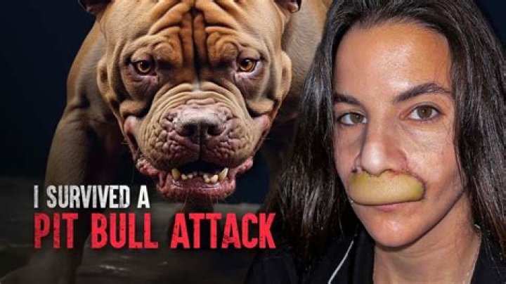 
Lily Norton GoFundMe raises over $31,000 as Chesterville girl remains in critical condition after pitbull attack 
