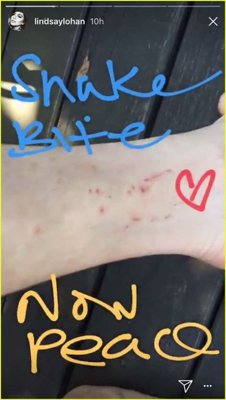 Even a Snake Bite on a Trip to Thailand Can’t Cure Lindsay Lohan’s Weird Accent