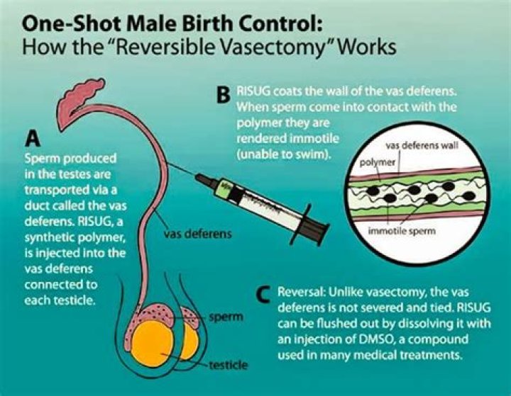 The World's First Male Birth Control Injection Is Coming To India