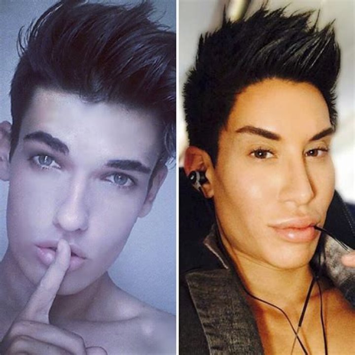 Human Ken DollMeet the Man Who Spent $50K on Plastic Surgery to Look Like Barbie’s Boyfriend — But How Does He Compare to That Other Human Ken Doll?
