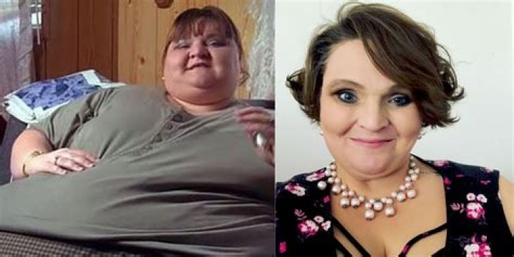Melissa From ‘My 600-Lb Life’ Prepares For Emergency Surgery After Finding Mass in Stomach