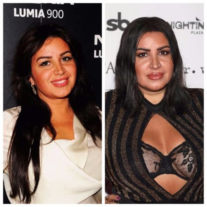 ‘Shahs of Sunset’ Star MJ May Have Gotten a Liquid Nose Job Before Her Wedding (EXCLUSIVE)