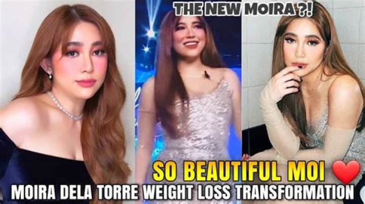 Moira Dela Torre | Before And After Surgery And New Look