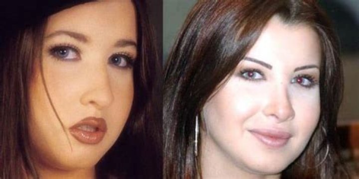Nancy Ajram Before And After: Has The Lebanese Singer Undergone Plastic Surgery?